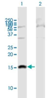 Western Blot: SH2D1B Antibody [H00117157-B01P]