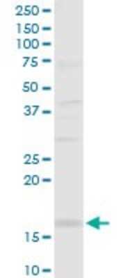 Western Blot: SH2D1B Antibody [H00117157-D01P]