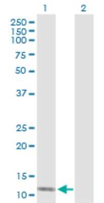 Western Blot: SH2D1B Antibody [H00117157-D01P]