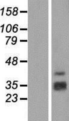 Western Blot: SH2D1B Overexpression Lysate [NBP2-05818]