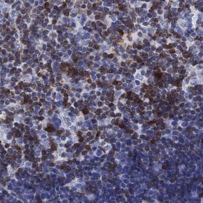 Immunohistochemistry-Paraffin: SH2D2A Antibody [NBP3-17766]