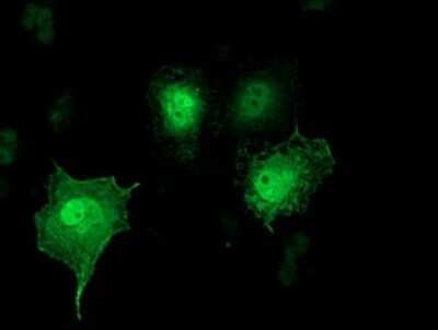 Immunocytochemistry/ Immunofluorescence: SH2D2A Antibody (OTI4F3) - Azide and BSA Free [NBP2-74153]
