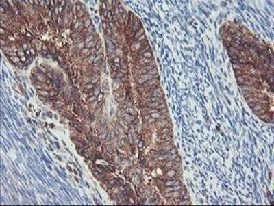 Immunohistochemistry: SH2D2A Antibody (OTI4F3) - Azide and BSA Free [NBP2-74153]