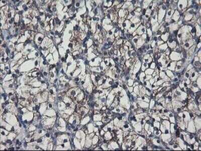Immunohistochemistry: SH2D2A Antibody (OTI4F3) - Azide and BSA Free [NBP2-74153]