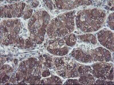 Immunohistochemistry: SH2D2A Antibody (OTI4F3) - Azide and BSA Free [NBP2-74153]