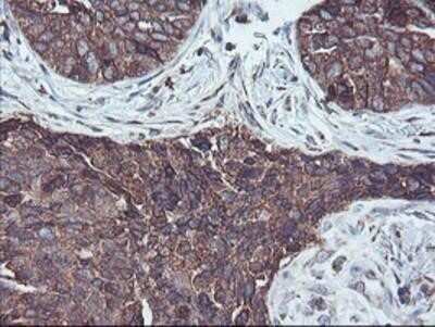 Immunohistochemistry: SH2D2A Antibody (OTI4F3) - Azide and BSA Free [NBP2-74153]