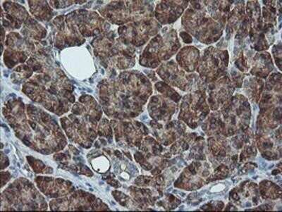 Immunohistochemistry: SH2D2A Antibody (OTI4F3) - Azide and BSA Free [NBP2-74153]