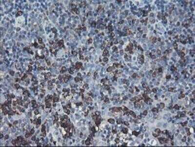 Immunohistochemistry: SH2D2A Antibody (OTI4F3) - Azide and BSA Free [NBP2-74153]