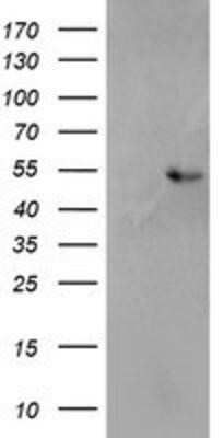 Western Blot: SH2D2A Antibody (OTI4F3)Azide and BSA Free [NBP2-74153]