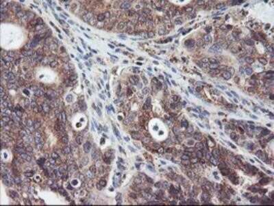 Immunohistochemistry-Paraffin: SH2D2A Antibody (OTI4F3) [NBP2-01828]