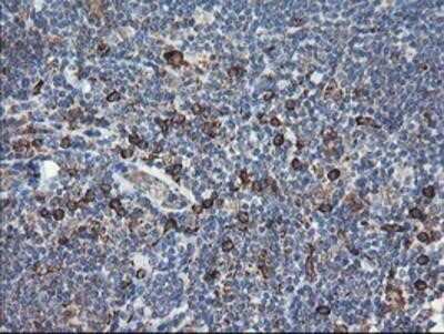 Immunohistochemistry-Paraffin: SH2D2A Antibody (OTI4F3) [NBP2-01828]