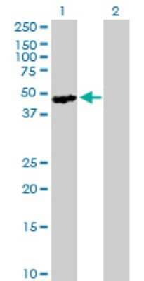 Western Blot: SH2D2A Antibody [H00009047-B02P]