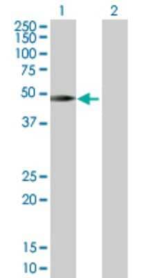 Western Blot: SH2D2A Antibody [H00009047-D01P]