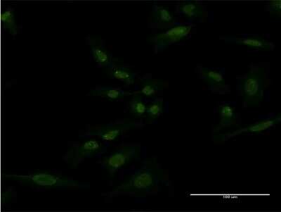 Immunocytochemistry/ Immunofluorescence: SH2D3A Antibody (3B11) [H00010045-M04]