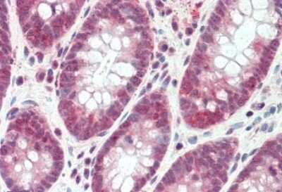 Immunohistochemistry-Paraffin: SH2D3A Antibody [NBP1-36986]