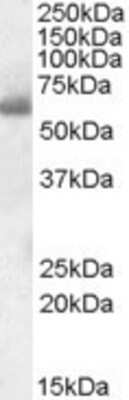 Western Blot: SH2D3A Antibody [NBP1-36986]