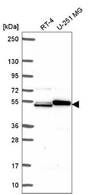 Western Blot: SH2D3A Antibody [NBP2-57054]