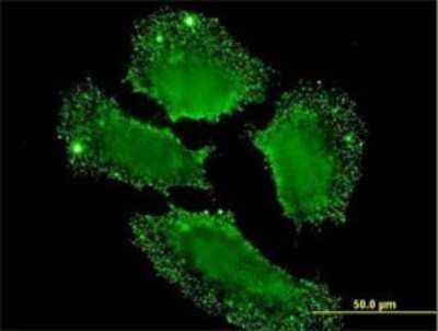 Immunocytochemistry/ Immunofluorescence: SH2D3C Antibody (1B6) [H00010044-M04]