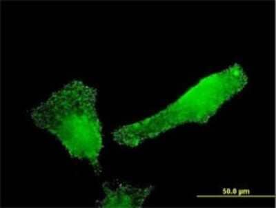 Immunocytochemistry/ Immunofluorescence: SH2D3C Antibody (2E3) [H00010044-M02]