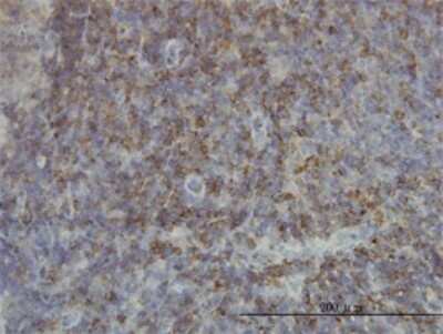 Immunohistochemistry-Paraffin: SH2D3C Antibody (3B2) [H00010044-M01]