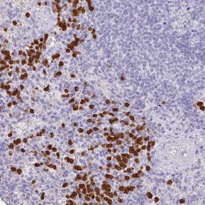 Immunohistochemistry-Paraffin: SH2D3C Antibody [NBP2-13306]