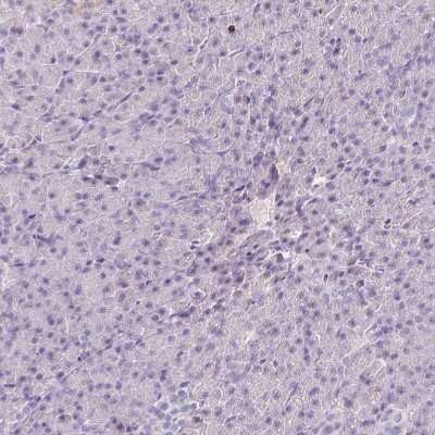 Immunohistochemistry-Paraffin: SH2D3C Antibody [NBP2-13306]