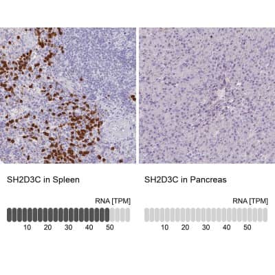 Immunohistochemistry-Paraffin: SH2D3C Antibody [NBP2-13306]