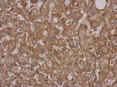 Immunohistochemistry-Paraffin: SH2D3C Antibody [NBP2-20341]