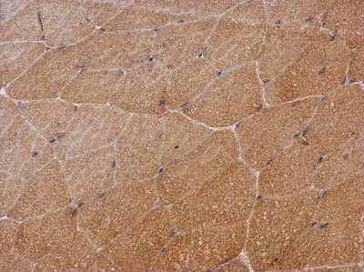 Immunohistochemistry-Paraffin: SH2D3C Antibody [NBP2-20341]