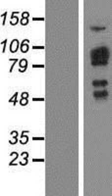 Western Blot: SH2D3C Overexpression Lysate [NBP2-10012]