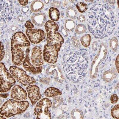 Immunohistochemistry-Paraffin: SH2D4A Antibody [NBP1-82157]