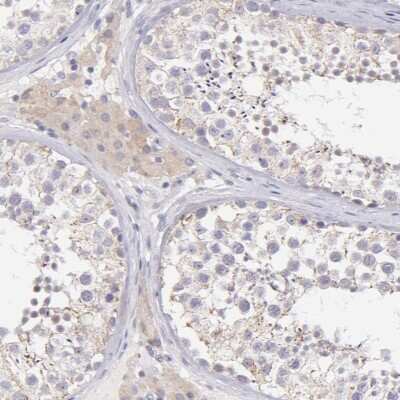 Immunohistochemistry-Paraffin: SH2D4A Antibody [NBP1-82157]