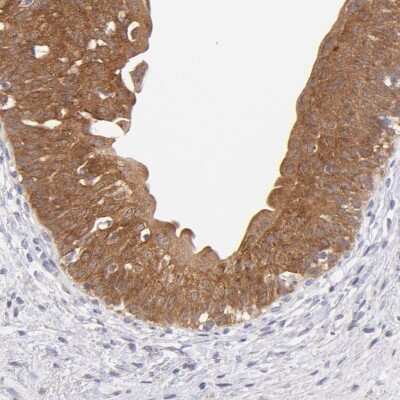 Immunohistochemistry-Paraffin: SH2D4A Antibody [NBP1-82157]