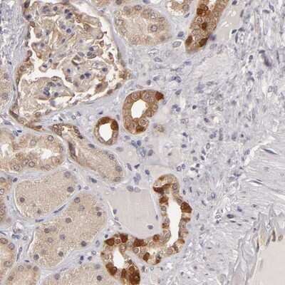 Immunohistochemistry-Paraffin: SH2D4A Antibody [NBP1-82158]