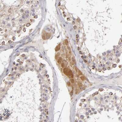 Immunohistochemistry-Paraffin: SH2D4A Antibody [NBP1-82158]