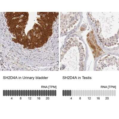 Immunohistochemistry-Paraffin: SH2D4A Antibody [NBP1-82158]