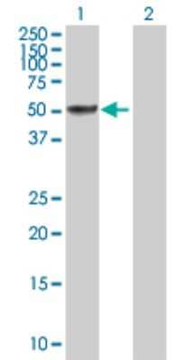 Western Blot: SH2D4A Antibody [H00063898-D01P]