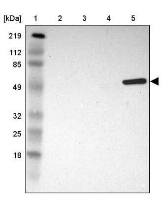 Western Blot: SH2D4A Antibody [NBP1-82157]