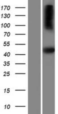 Western Blot: SH2D5 Overexpression Lysate [NBP2-08247]