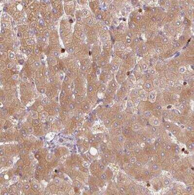 Immunohistochemistry-Paraffin: SH2D6 Antibody [NBP2-30554]