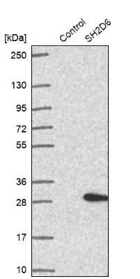 Western Blot: SH2D6 Antibody [NBP2-30554]