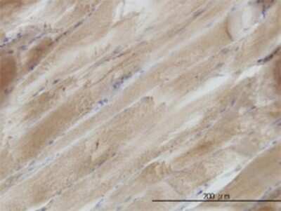 Immunohistochemistry-Paraffin: SH3BGR Antibody (3B7) [H00006450-M01]