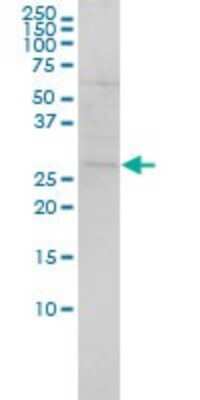 Western Blot: SH3BGR Antibody (3B7) [H00006450-M01]