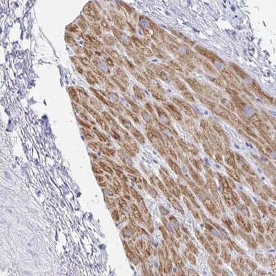 Immunohistochemistry-Paraffin: SH3BGR Antibody [NBP2-38161]
