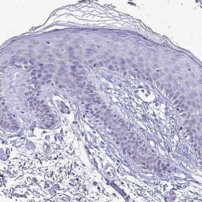 Immunohistochemistry-Paraffin: SH3BGR Antibody [NBP2-38161]