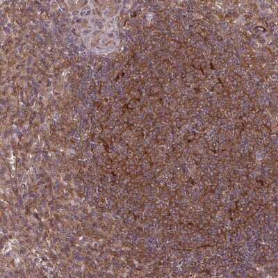 Immunohistochemistry-Paraffin: SH3BGRL Antibody [NBP2-33609]