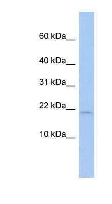 Western Blot: SH3BGRL Antibody [NBP1-57643]