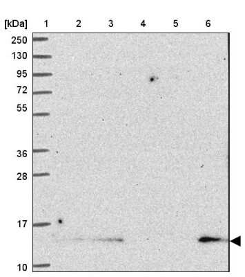 Western Blot: SH3BGRL Antibody [NBP2-33609]