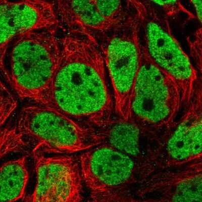 Immunocytochemistry/ Immunofluorescence: SH3BGRL2 Antibody [NBP2-14598]