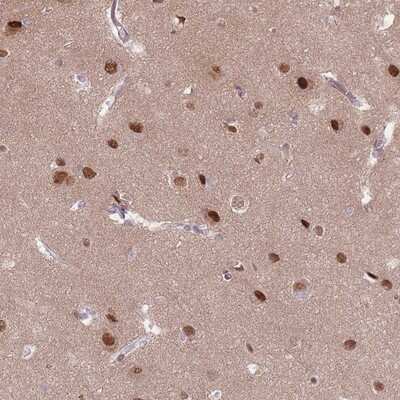 Immunohistochemistry-Paraffin: SH3BGRL2 Antibody [NBP2-14598]